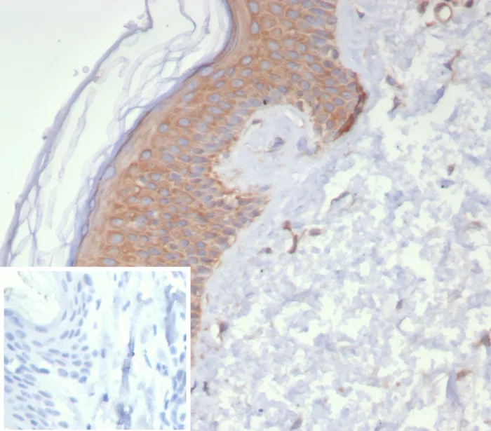 NM23-H2/NME2 Antibody (NME2/6437)