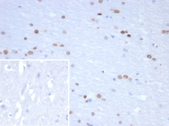 Neurogenin-3 Antibody (NGN3/1809)