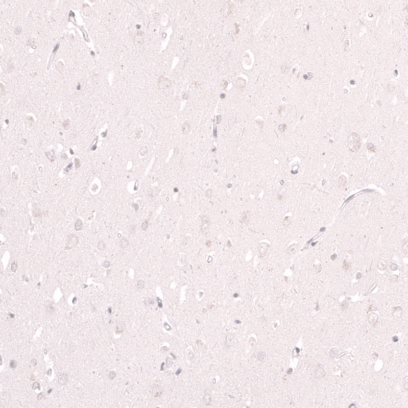 Lactase Antibody (CL14133)