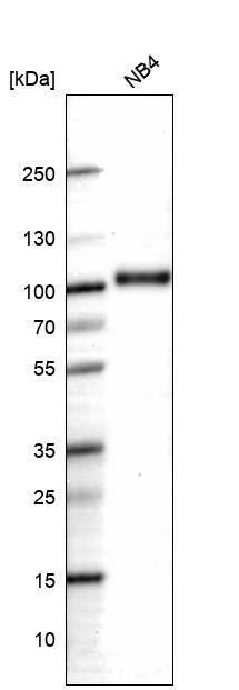 Myeloperoxidase/MPO Antibody (CL15002)