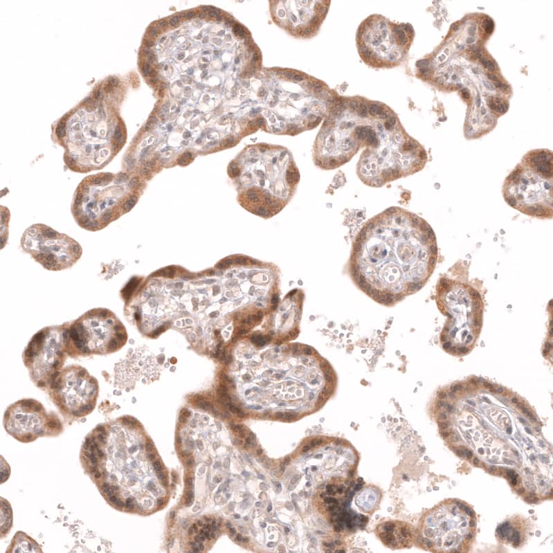 R-Spondin 2 Antibody (CL14321)