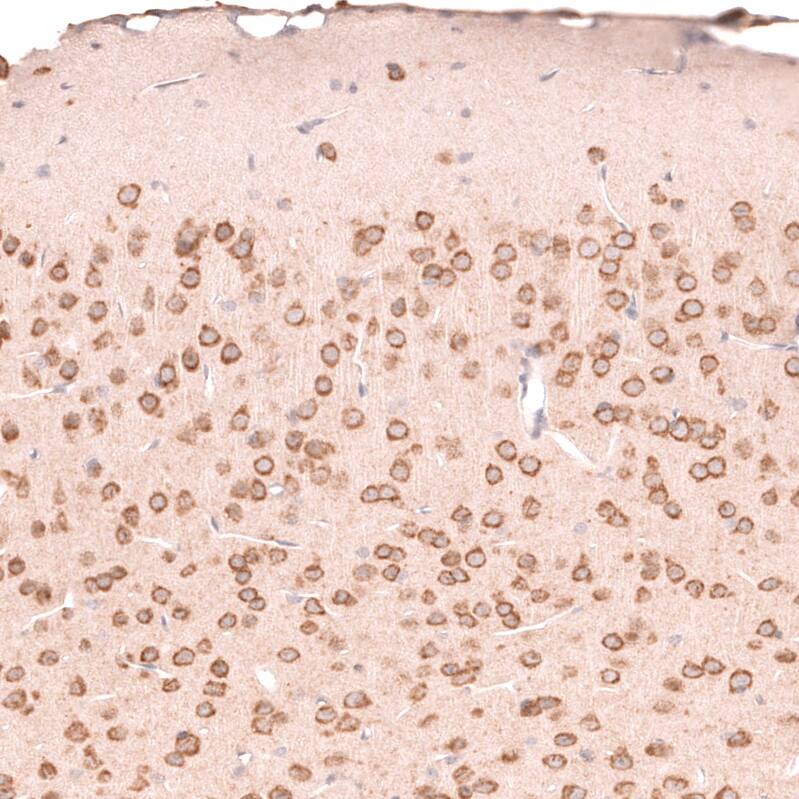 R-Spondin 2 Antibody (CL14321)