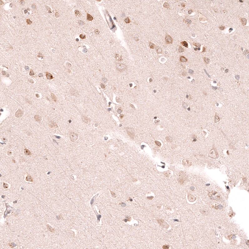 R-Spondin 2 Antibody (CL14321)