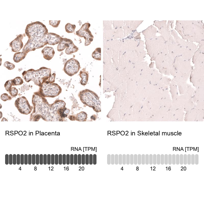 R-Spondin 2 Antibody (CL14321)