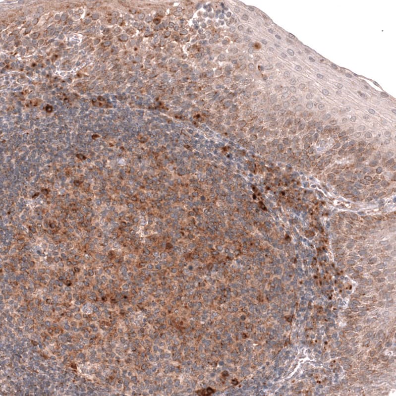 Porimin Antibody (CL14381)