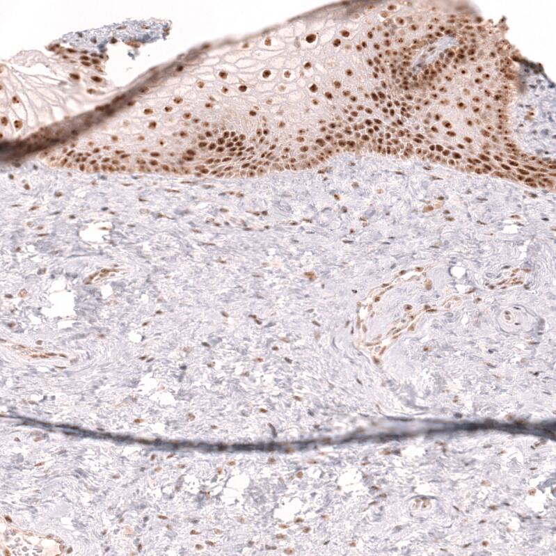 TFEB Antibody (CL14112)