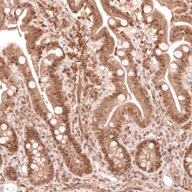 TFEB Antibody (CL14112)