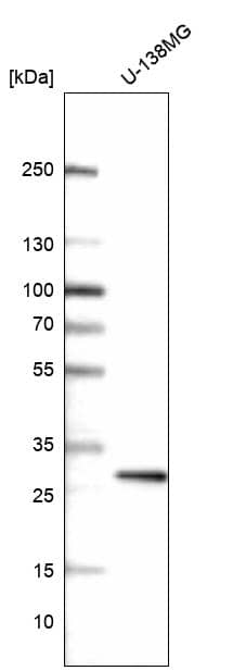 PRRX1 Antibody (CL14469)