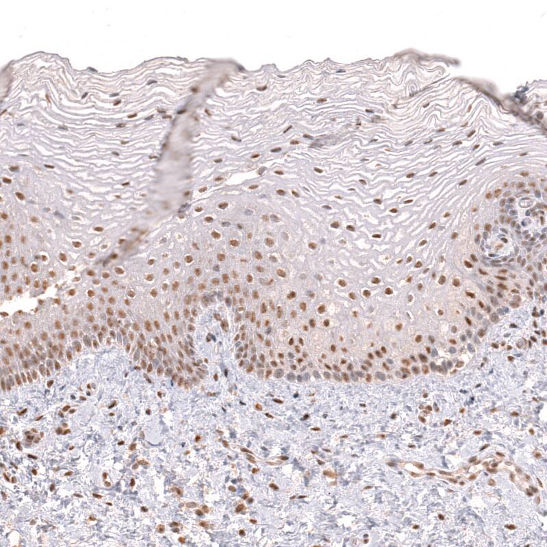 PRRX1 Antibody (CL14471)