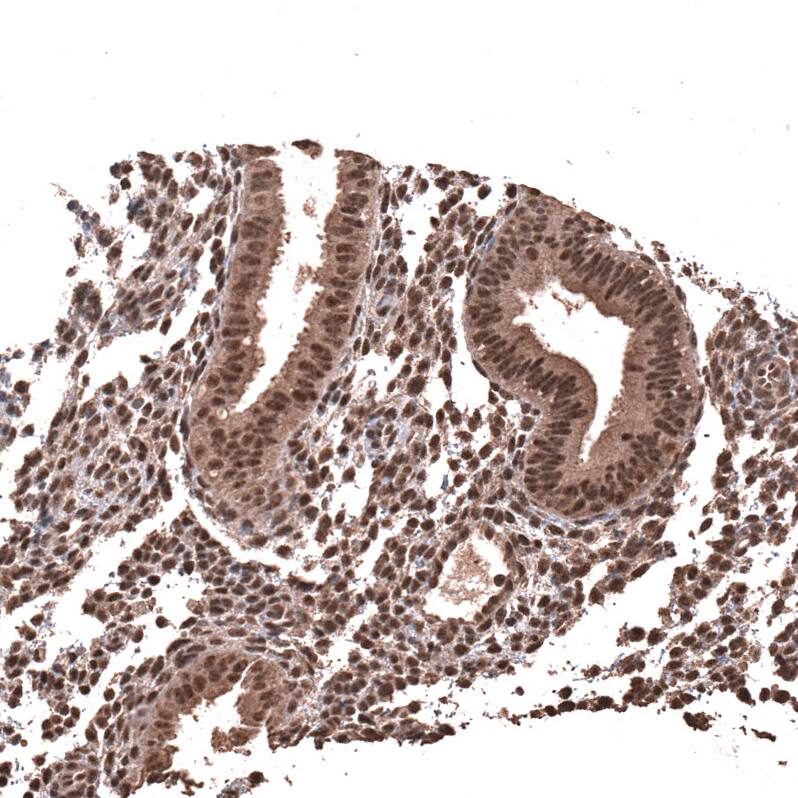 PRRX1 Antibody (CL14471)
