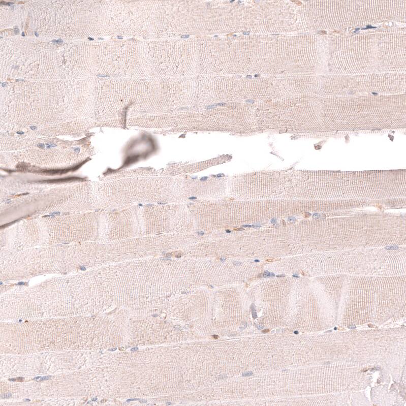 TYKi Antibody (CL14479)