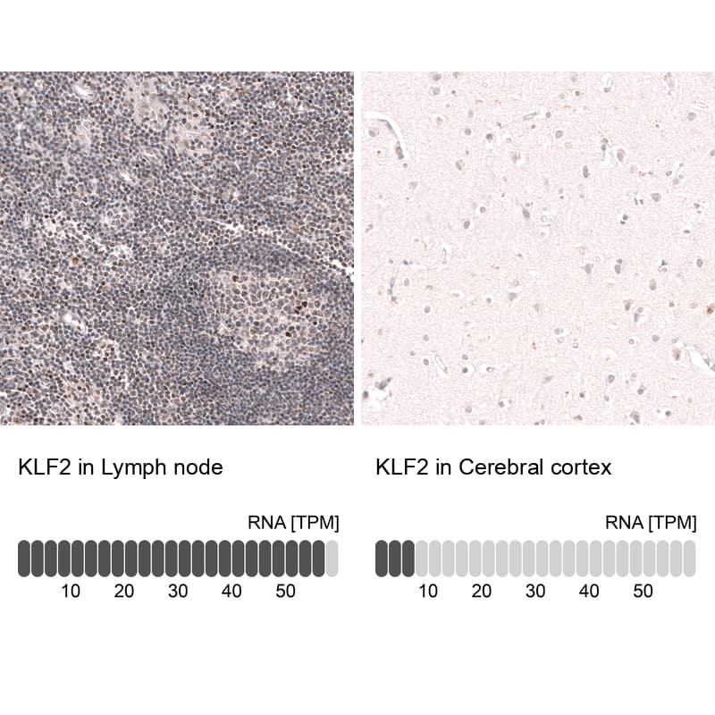 KLF2 Antibody (CL14502)