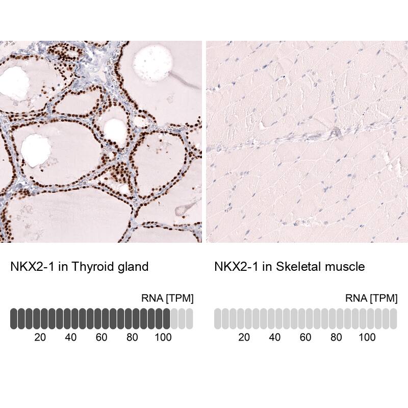 TTF-1 / NKX2-1 Antibody (CL14523)