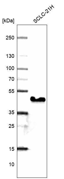 TTF-1 / NKX2-1 Antibody (CL14528)