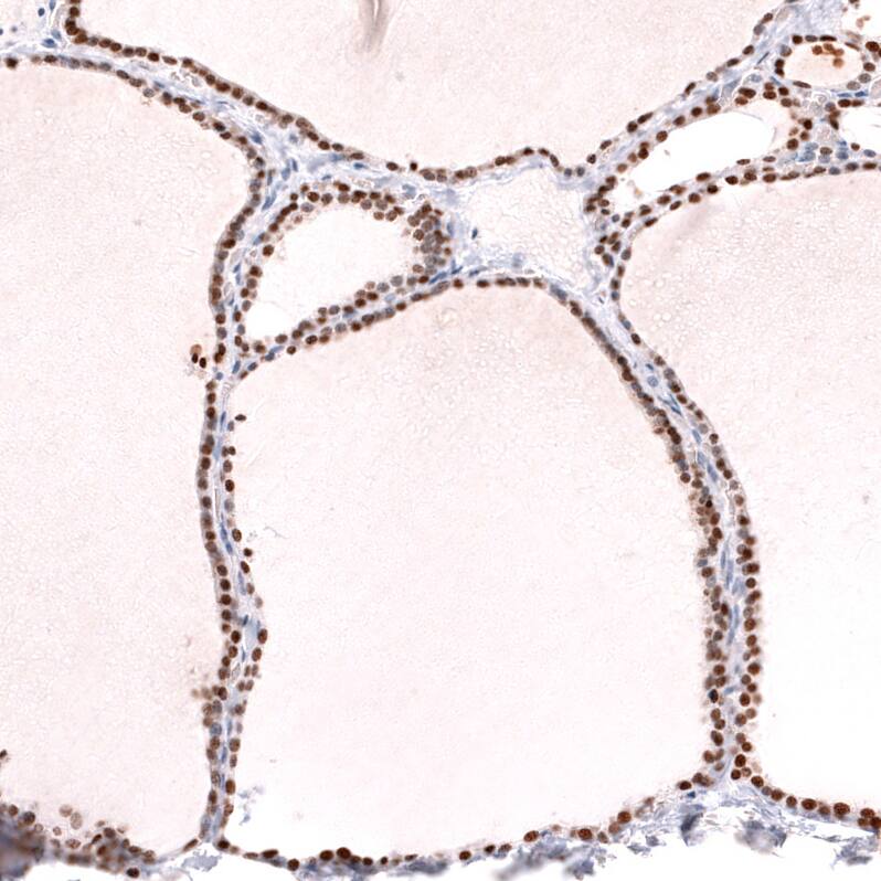 TTF-1 / NKX2-1 Antibody (CL14528)