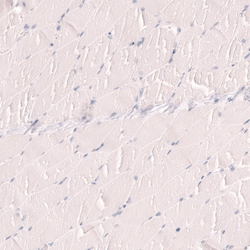 TTF-1 / NKX2-1 Antibody (CL14528)