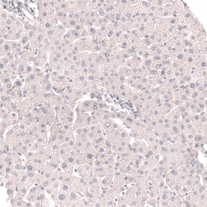 TTF-1 / NKX2-1 Antibody (CL14528)