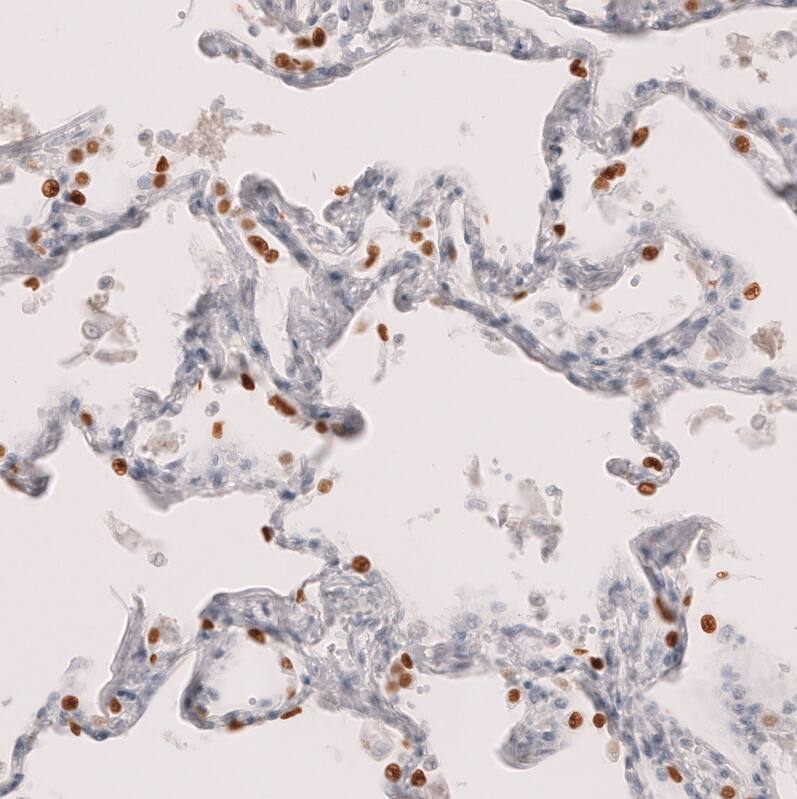 TTF-1 / NKX2-1 Antibody (CL14531)