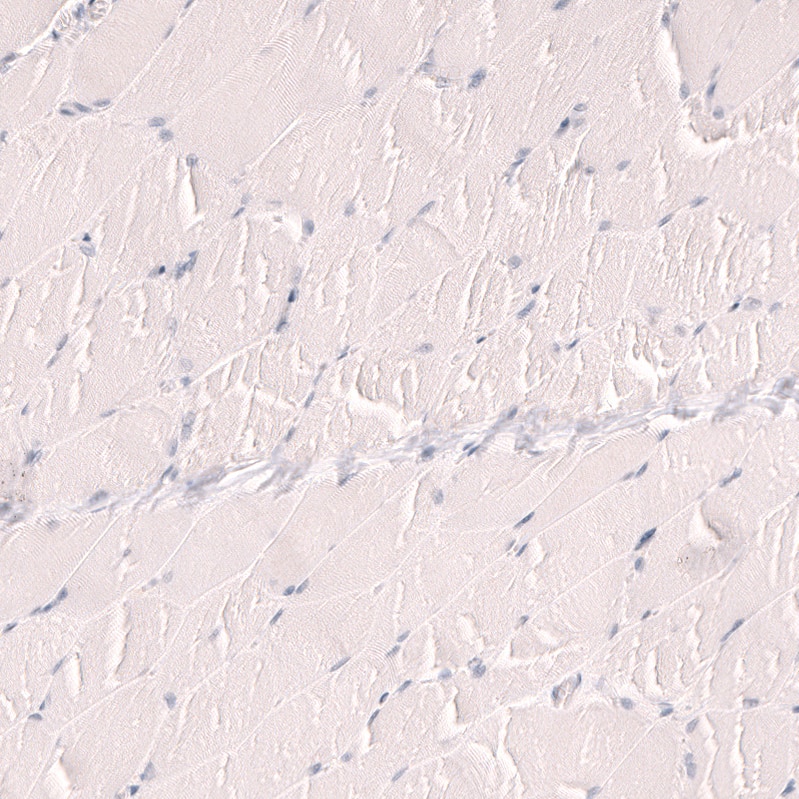 TTF-1 / NKX2-1 Antibody (CL14531)