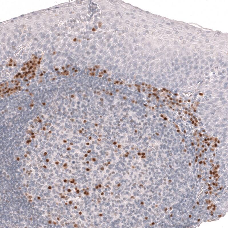 IRF4 Antibody (CL14615)