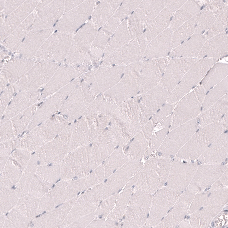 IRF4 Antibody (CL14615)
