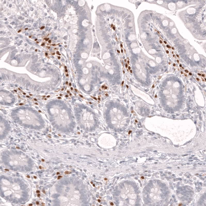 IRF4 Antibody (CL14615)