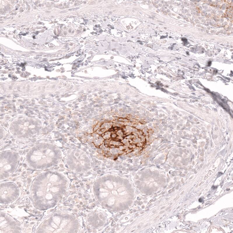 CD21 Antibody (CL14552)