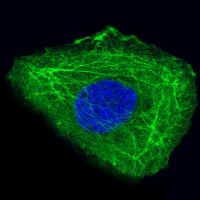 Cytokeratin 14 Antibody (CL14565) - BSA Free Immunocytochemistry/ Immunofluorescence: Cytokeratin 14 Antibody (CL14565) [NBP3-26868]