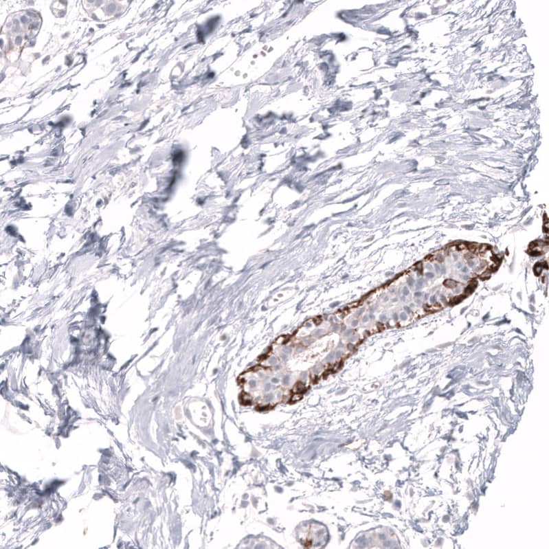 Cytokeratin 14 Antibody (CL14565)