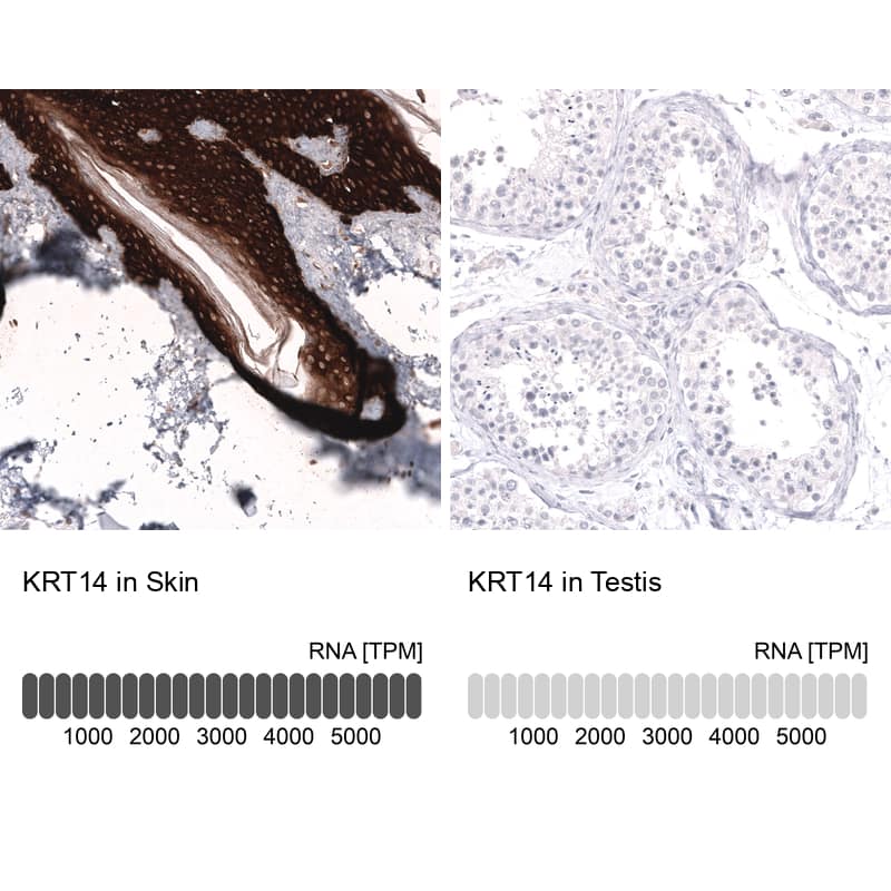 Cytokeratin 14 Antibody (CL14568)