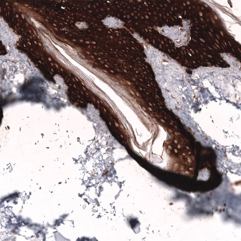 Cytokeratin 14 Antibody (CL14568)