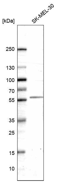 5-HT2B Antibody (CL14576)