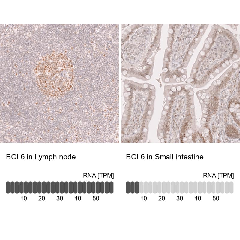 Bcl-6 Antibody (CL14611)