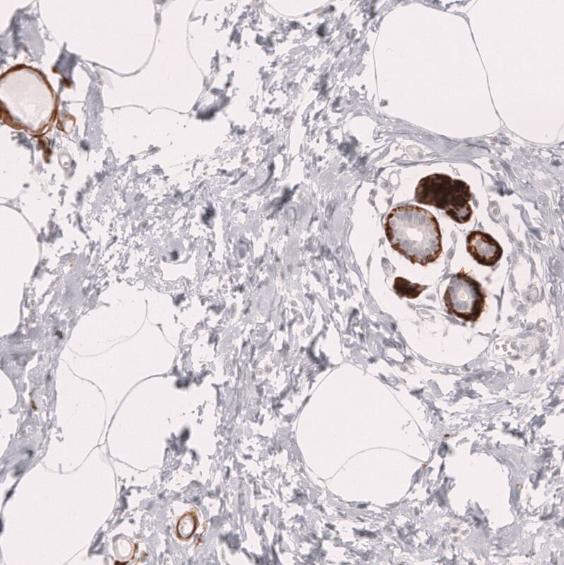 Myosin heavy chain 11 Antibody (CL14617)