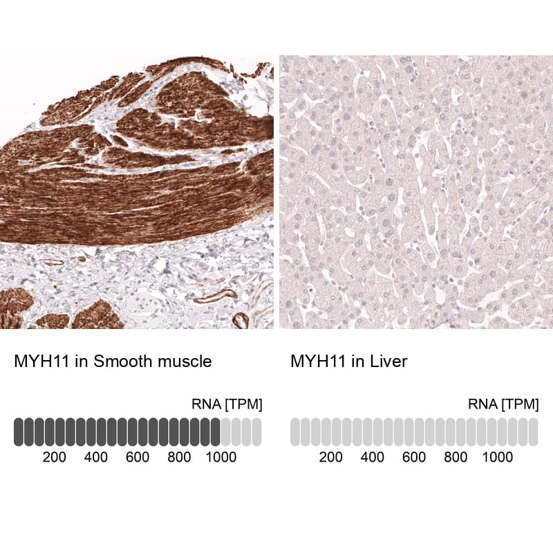 Myosin heavy chain 11 Antibody (CL14617)