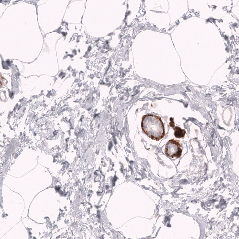 Myosin heavy chain 11 Antibody (CL14619)
