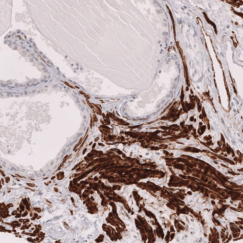 Myosin heavy chain 11 Antibody (CL14619)