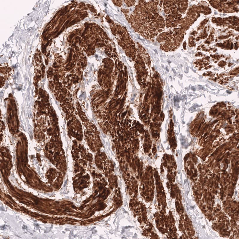 Myosin heavy chain 11 Antibody (CL14619)