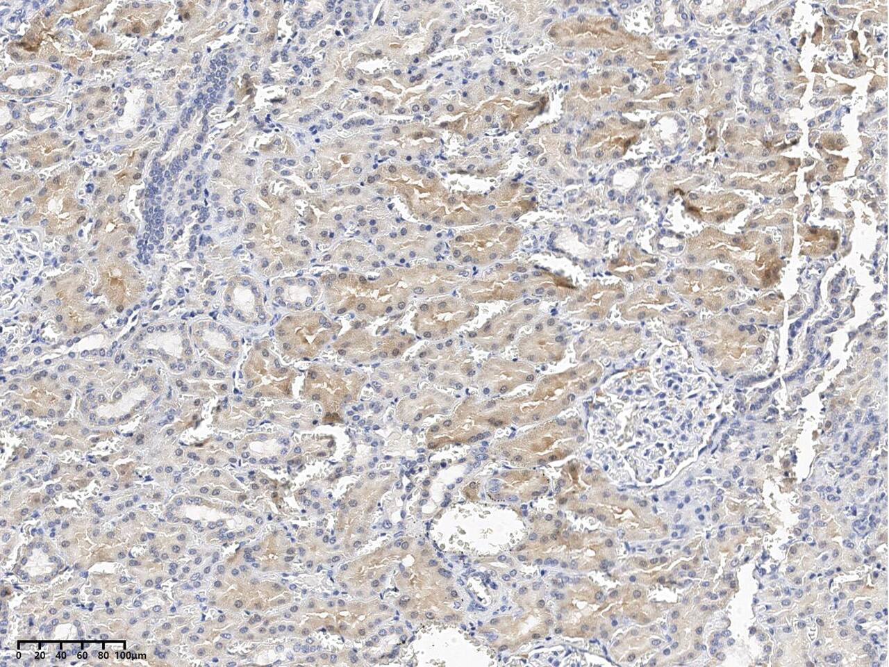 SMDT1 Antibody - Azide and BSA Free