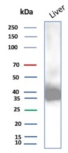 Aldo-keto Reductase 1C1/AKR1C1 Antibody (AKR1C1/9070)