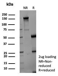 Aldo-keto Reductase 1C1/AKR1C1 Antibody (AKR1C1/9069)