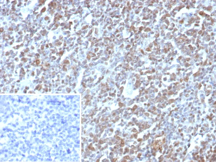 E2F-4 Antibody (E2F4/8984R)