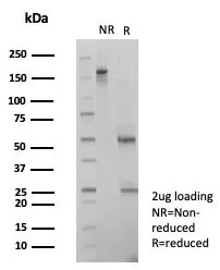 SNW1 Antibody (PCRP-SNW1-1C12)