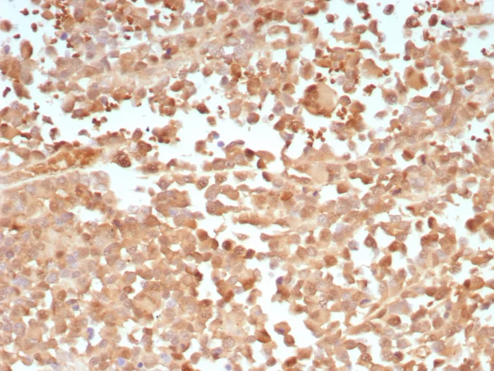 PRAME Antibody (PRAME/9188)