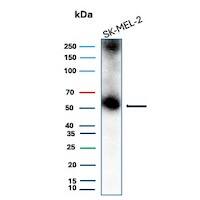 PRAME Antibody (PRAME/9188) - Azide and BSA Free Western Blot: PRAME Antibody (PRAME/9188) - Azide and BSA Free [NBP3-26932] -