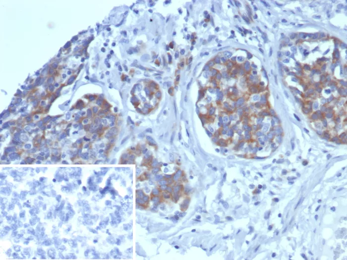 alpha 1-Microglobulin Antibody (AMBP/4533)