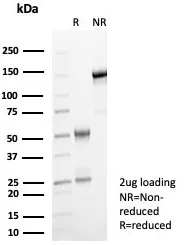 GBP1 Antibody (GBP1/7617)