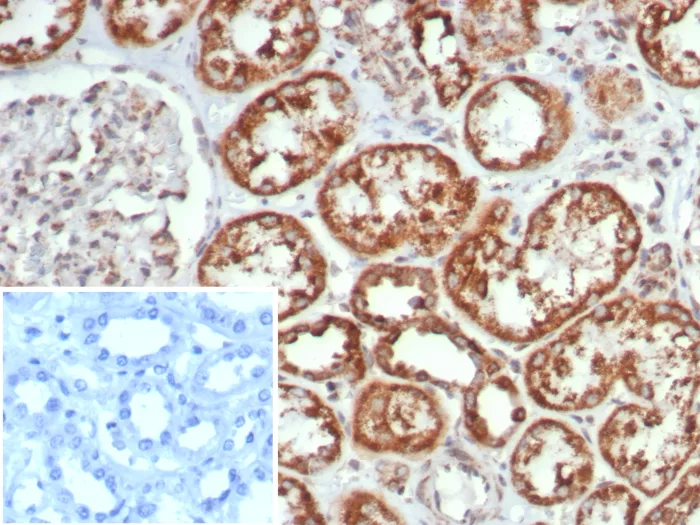 MR1 Antibody (MR1/7579)