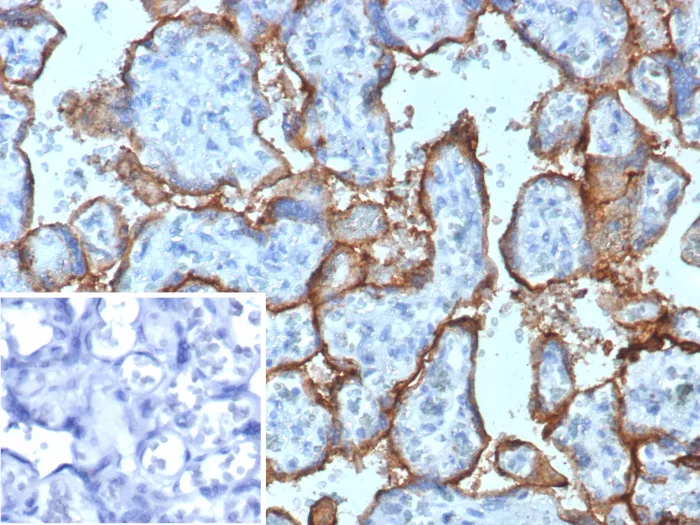 RHAMM/CD168 Antibody (HMMR/8021)