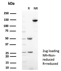 HSP90 alpha Antibody (HSP90AA1/7426)